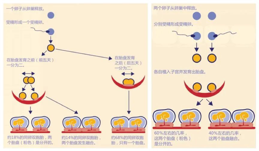 什么是“半同卵双胞胎”?全世界仅有两例被确认