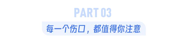 不小心被一个铁钉扎破脚,会怎样?该打破伤风疫苗还是破伤风针呢?